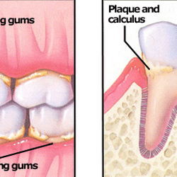 John H Lake, DDS