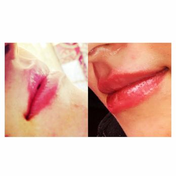 Britt’s Beauty Bar - Before photo left, after photo right - Aestheticians Near Me Britt’s Beauty Bar - Before photo left, after photo right - Aestheticians Near Me