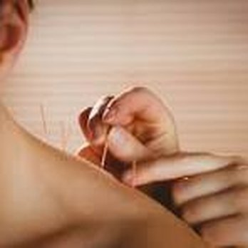 Acuity Acupuncture - Acupuncture Near Me - Miami Beach, Florida