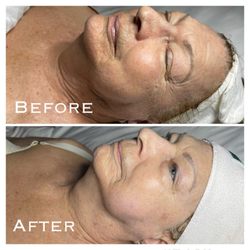 Incandescent Skin - DMK Stemzyme and enzyme is your holistic firming facial.