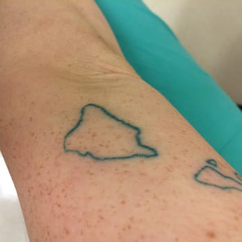 Tattoo Paradise - Inconsistent line work,  heavy handed on one side with some blowout and too light on the other - Tattoo Near Me - Washington, DC, District of Columbia