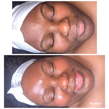 Beyouskinn - Brightening Facial Treatment - Skin Care Near Me - Tampa, Florida Beyouskinn - Brightening Facial Treatment - Skin Care Near Me - Tampa, Florida