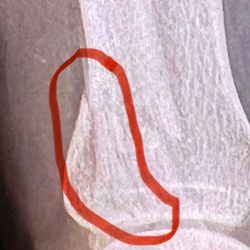 TruOrtho - ER X-ray
