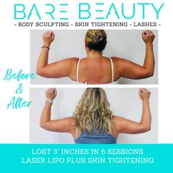 Bare Beauty MedSPA