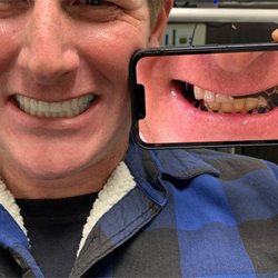 Palani Center For Dental Implants - The power of dental implants in smile restoration #allonfour #dentalimplants