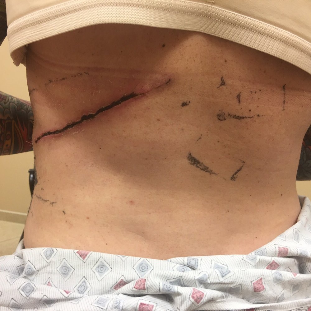 Semone Rochlin, DO, FACOS - This is where the skin and muscle came from - Cosmetic Surgeons Near Me - Scottsdale, Arizona Semone Rochlin, DO, FACOS - This is where the skin and muscle came from - Cosmetic Surgeons Near Me - Scottsdale, Arizona