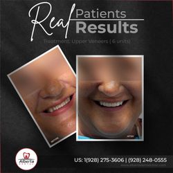Alberta Dental - Veneer treatment at Alberta Dental shows how a natural-looking smile can boost your confidence.