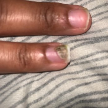 Happiness Nails - My first time getting my nails done there and when I took my nails off I had a fungus.... - Nail Salons Near Me - Pomona, California Happiness Nails - My first time getting my nails done there and when I took my nails off I had a fungus.... - Nail Salons Near Me - Pomona, California