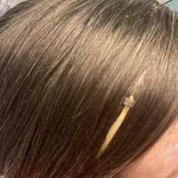 Micro links showing through (because placed too close to my crown)