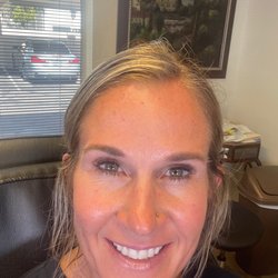 Genesis Rejuvenation - No makeup!!!!!