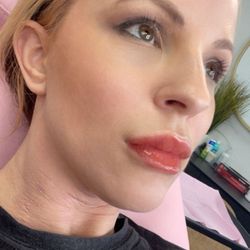 Becky Does Botox - Fresh lips IMMEDIATELY after injections