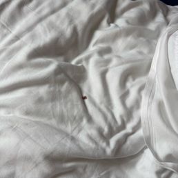Blood from killed bed bug...yuck. Blood from killed bed bug...yuck.