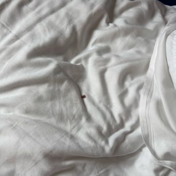 Aloft by Marriott New York Brooklyn - Blood from killed bed bug...yuck. - Hotels Near Me - Brooklyn, New York Aloft by Marriott New York Brooklyn - Blood from killed bed bug...yuck. - Hotels Near Me - Brooklyn, New York