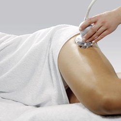 Erick F Carcamo, MD - Ultrasound cavitation Cellulitis