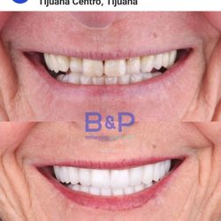 B&P Dental - Before & after