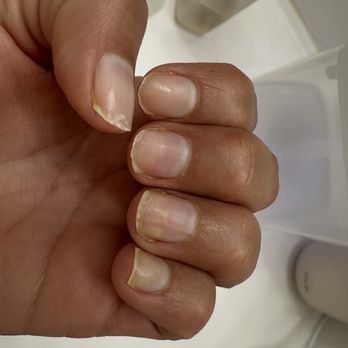 Ele Ela Nail Salon - The yellow is from tumeric on my hands but as you can see it really stained the left over acrylic left on my nails that wasn't removed. - Nail Salons Near Me - Pacifica, California
