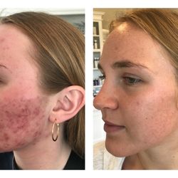 Shanti Skincare Studio