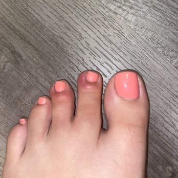 Elegance Nails & Spa - Toe infection - Nail Salons Near Me - Los Alamitos, California Elegance Nails & Spa - Toe infection - Nail Salons Near Me - Los Alamitos, California