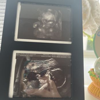 Unique Ultrasound Redlands - Ultrasound Imaging Centers Near Me - Redlands, California