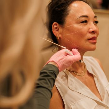 Ilūmra Skin - Facial balancing with HA fillers & biostimulators - Medical Spas Near Me - Raleigh, North Carolina Ilūmra Skin - Facial balancing with HA fillers & biostimulators - Medical Spas Near Me - Raleigh, North Carolina