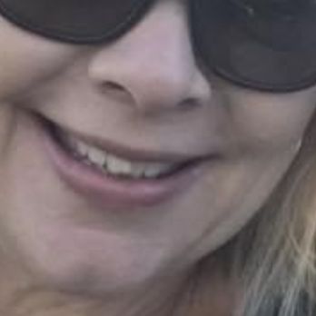 Berro Orthodontics - My teeth were completely crossed in the front. - Orthodontists Near Me - Los Alamitos, California
