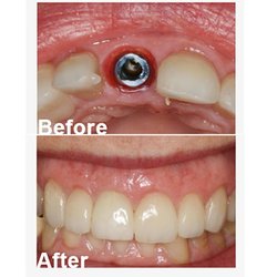 Desert Dental Care - La Quinta Dentist