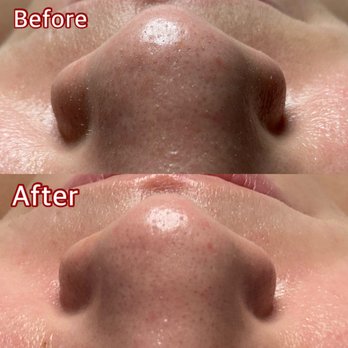 All Thngs Beauty - Deep cleanse - Waxing Near Me - Rancho Cucamonga, California All Thngs Beauty - Deep cleanse - Waxing Near Me - Rancho Cucamonga, California