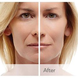 Reneu Health & Medispa Jill P Wohlfeil