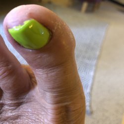 Nail Palace - Cut twice, infected & swollen same day as Pedi 3-2-23 !