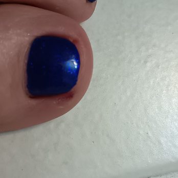 Flagstaff Nails Salon - Bleeding toes. Do nor go to this dirty place. INFECTION SET IN - Nail Salons Near Me - Flagstaff, Arizona