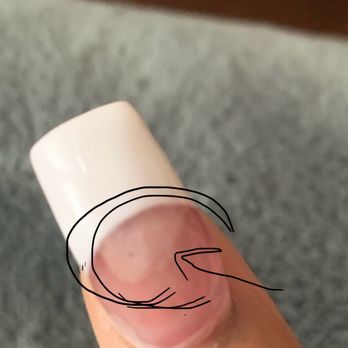 Highland Nails & Spa - Nail got an infection.. - Nail Salons Near Me - Flower Mound, Texas Highland Nails & Spa - Nail got an infection.. - Nail Salons Near Me - Flower Mound, Texas