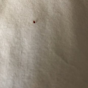 Pea Soup Andersen's Inn - bed bug in the second room - Hotels Near Me - Buellton, California Pea Soup Andersen's Inn - bed bug in the second room - Hotels Near Me - Buellton, California
