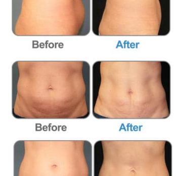 Adrienne Skin Care - Skin Care Near Me - Encino, California Adrienne Skin Care - Skin Care Near Me - Encino, California