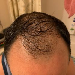 Armani Medical - Before