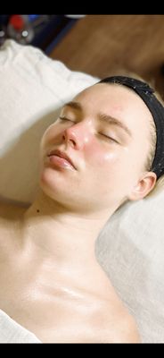 Buttercup Skin Care by null