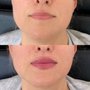 Photo of smith & co botox specialist