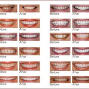 NEIGHBORHOOD FAMILY DENTISTRY - Updated September 2025 - 14