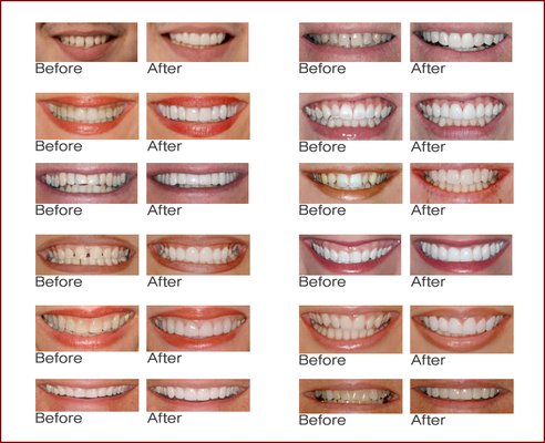 Neighborhood Family Dentistry - Serving Madison Heights, MI