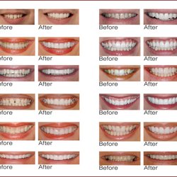 Neighborhood Family Dentistry
