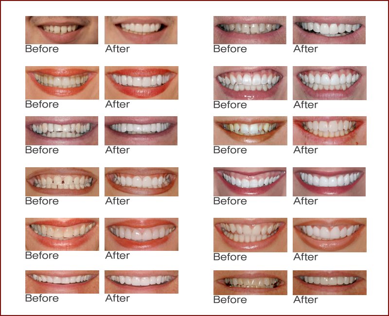 NEIGHBORHOOD FAMILY DENTISTRY Updated September 2024 11 Reviews