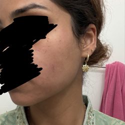 Herbal Touch Skin Care