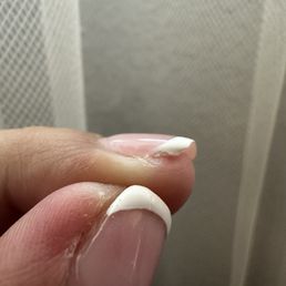 1 week after: nail is chipped. 1 week after: nail is chipped.