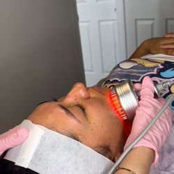 Microcurrent bio treatment