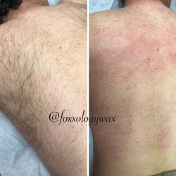 Foxxology Wax Studio - Back wax