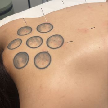 Root & Shen Wellness - Acupuncture for women's health, stress and anxiety - Acupuncture Near Me - Torrance, California Root & Shen Wellness - Acupuncture for women's health, stress and anxiety - Acupuncture Near Me - Torrance, California