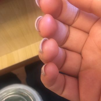 VIP Nails - All my nails being separated - Nail Salons Near Me - Amherst, Massachusetts