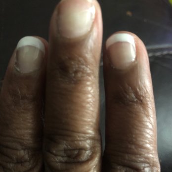 Luxury Nail & Spa - One day of wear from a "gel nail" French manicure. - Nail Salons Near Me - Shreveport, Louisiana Luxury Nail & Spa - One day of wear from a "gel nail" French manicure. - Nail Salons Near Me - Shreveport, Louisiana