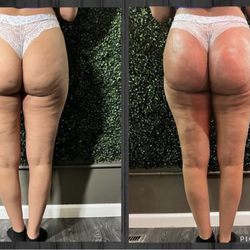 Beauty & Class Salon/Body Contouring - 1session of the vacuum buttlift