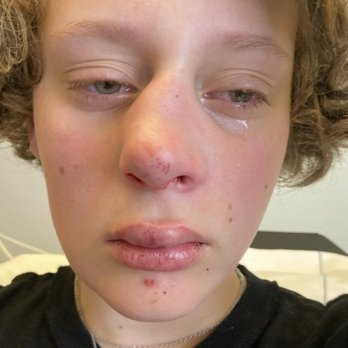 Altitude Trampoline Park Pueblo - KIDS BROKEN NOSE FROM UNMONITORED ACTIVITES IN DODGEBALL!!!! - Trampoline Parks Near Me - Pueblo, Colorado Altitude Trampoline Park Pueblo - KIDS BROKEN NOSE FROM UNMONITORED ACTIVITES IN DODGEBALL!!!! - Trampoline Parks Near Me - Pueblo, Colorado
