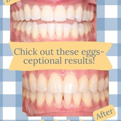 Carroll & Sutton Orthodontics - Spring into a fresh smile with this egg-straordinary orthodontic transformation!